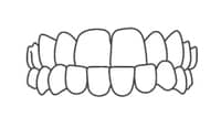 Illustration of properly aligned teeth and gums showing ideal dental occlusion and bite alignment.