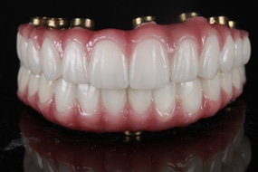 Full dental prosthesis with pink gums and white teeth on black background