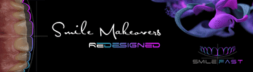 Smile Makeovers redesigned logo with purple flowers and dental branding elements on dark background.