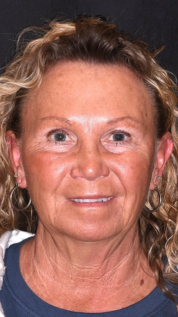 Woman smiling at camera against dark background, professional headshot for dental practice.